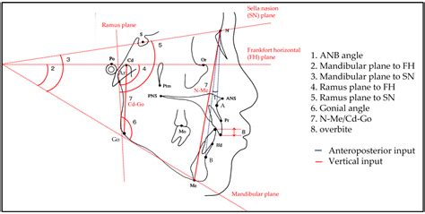 梁祐銘|Cephalometric Analysis